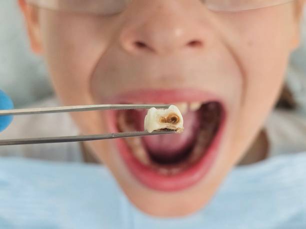 Best Weekend Emergency Dentist in Abingdon, IL